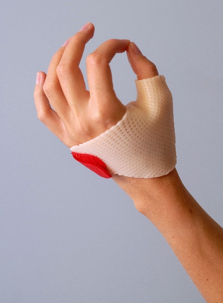 Blog: wat is handtherapie?